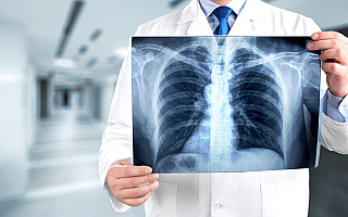 Sprawdź swoje płuca. NFZ zachęca do bezpłatnych badań spirometrycznych